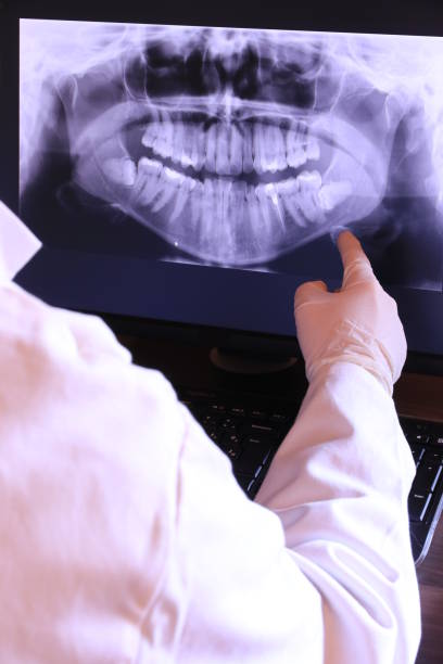 Best Emergency Dentist for Knocked-Out Tooth in Deer Park, NY